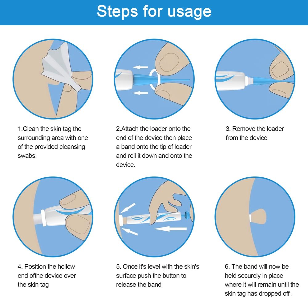 Skin tag Removal Kit